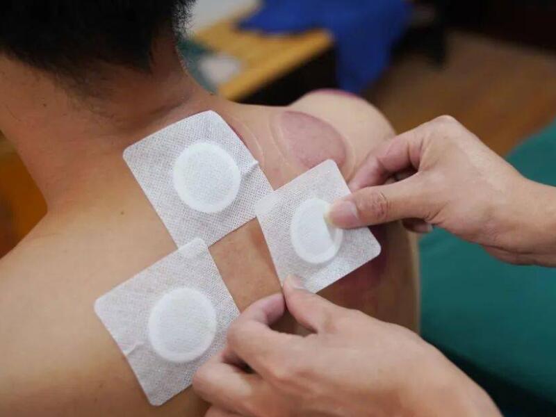 艾灸貼